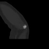 SPORK, NICO - 22.03.1976 - 02.08.2022 - CT obere Extremität - 18:01:46